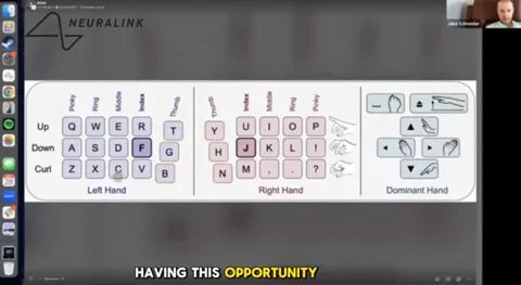 Neuralink 患者用意念打字速度达141字/分