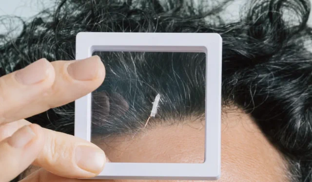 Robeauté 米粒大小的机器人,大脑肿瘤新希望