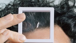 Robeauté 米粒大小的机器人，大脑肿瘤新希望