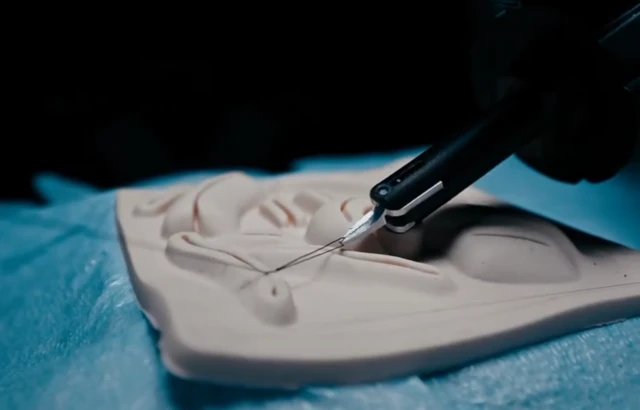 Aleph Surgery 获 a16z 750 万美元融资,打造 AI 驱动的外科医生