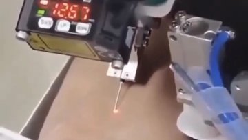 这个机器人抽血成功率高达94.3%